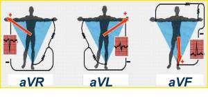 DERIVAÇÕES FRONTAIS Unipolares amplificadas dos membros (av = amplificada voltagem) avr => eletrodo explorador no membro superior