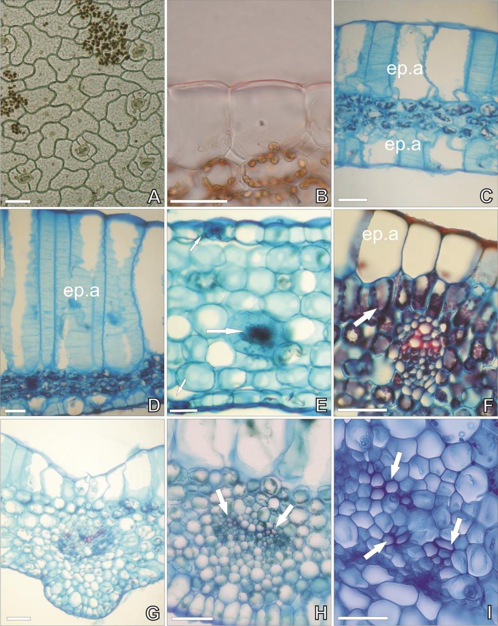 Fig. 4 Análise em microscopia de luz. (A) Prescottia stachyodes, epiderme com paredes sinuosas e estômatos com duas e três células anexas; escala = 50 µm.