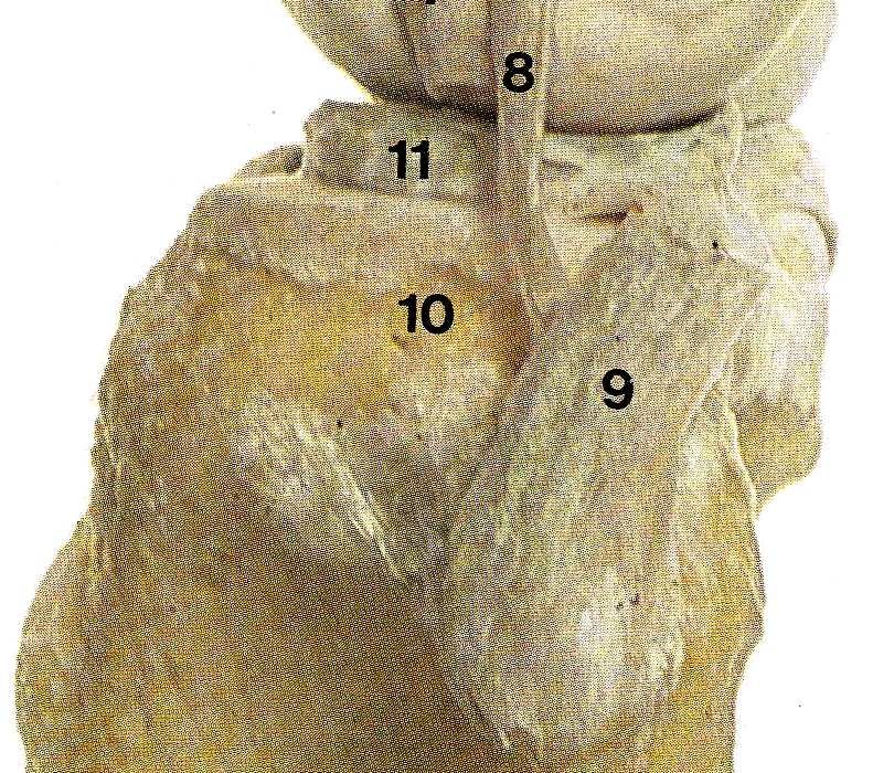 interno fémur Ligamento cruzado