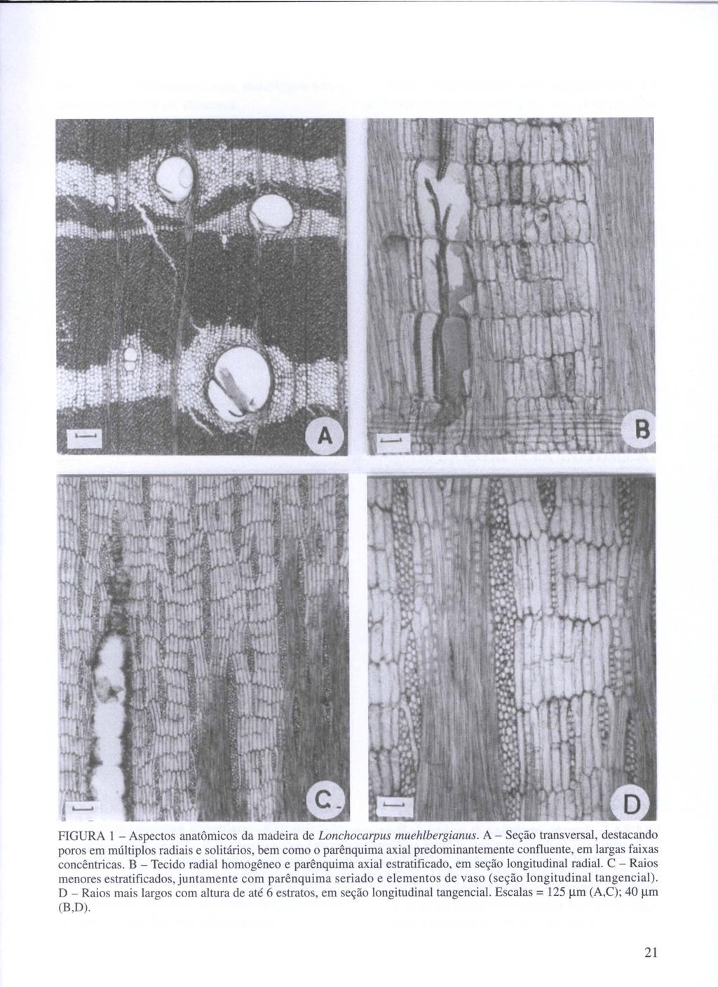 FIGURA 1 - Aspectos anatômicos da madeira de Lonchocarpus muehlbergianus.