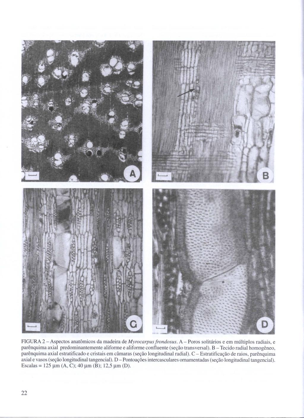 FIGURA 2 - Aspectos anatômicos da madeira de Myrocarpus frondosus. A - Poros solitários e em múltiplos radiais, e parênquima axial predominantemente aliforme e aliforme confluente (seção transversal).