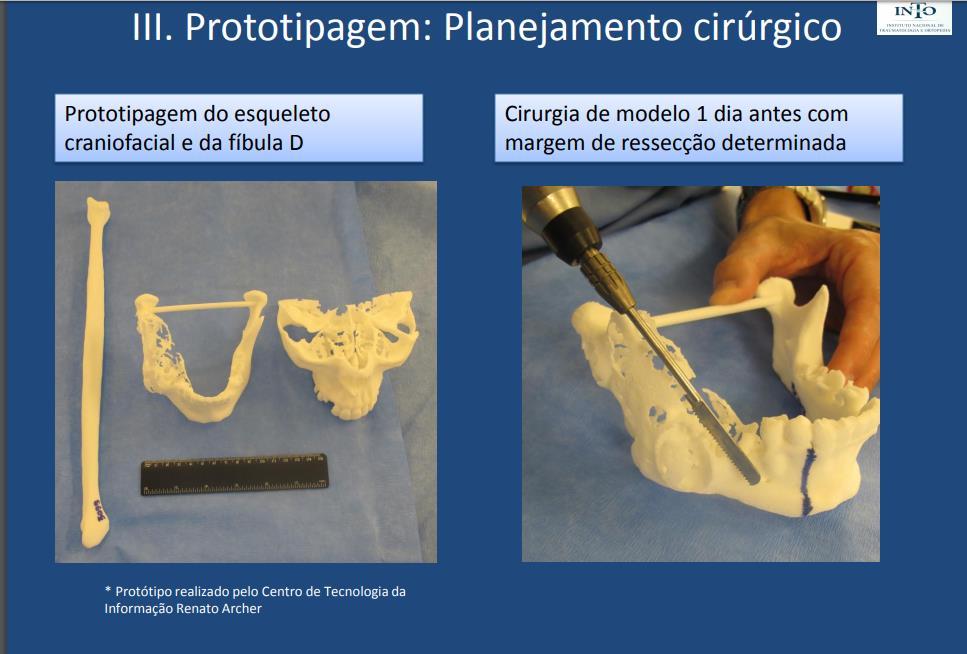 FUNDAMENTOS TÉCNICOS A prototipagem é um processo de construção para obter protótipos físicos a partir de modelos 3D digitais ou a partir da conversão de imagens obtidas da tomografia computadorizada