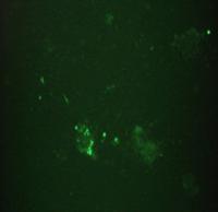 Lipofectamine 2000 (Invitrogen) 3 µg DNA: