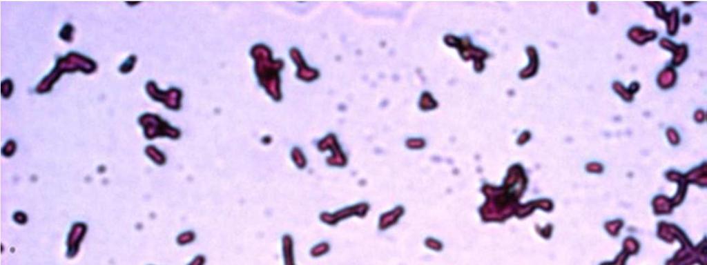 crescimento e, em contra partida, os Lactobacillus acidophilus