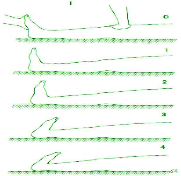 38 Figura 1. Mapa do Flexiteste com escores 0 a 4 para o movimento I - flexão dorsal do tornozelo. ANÁLISE ESTATÍSTICA Foi feita uma análise descritiva para as principais variáveis do estudo.