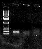 107 369 246 123 159bp B MW 1 2 3 1.107 369 246 123 159bp Fig.1. Analysis of PCR products (159bp) by agarose gel electrophoresis of extracted BoHV-5 DNA from supernatant of infected cells, fresh and formalin-fixed, paraffin embedded samples.