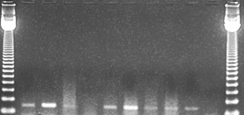 Lane MW: 123bp ladder (Invitrogen, Life Technologies, USA) Panel A: profile of positive results obtained by PCR performed directly from DNA extracted from fresh
