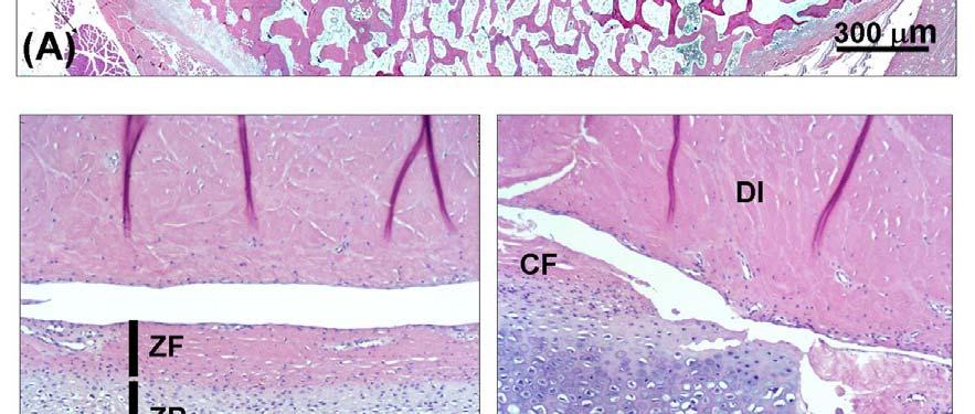 pterigóideo lateral (MP); B) detalhe da região central: zona de superfície articular fibrosa (ZF), zona proliferativa (ZP) e zona