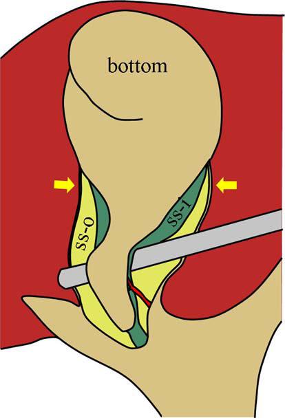 Visão crítica de segurança Honda G, et al