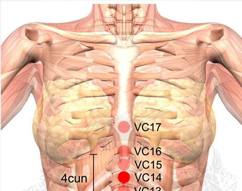 VC14