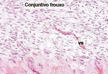 Componentes que formam essa substância: glicosaminoglicanos, proteoglicanos, glicoproteínas, água e íons. É incolor e viscosao, preenche espaços entre fibras e células do tecido conjuntivo.