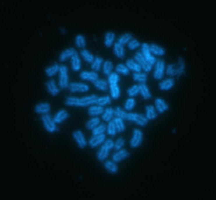 cromossomo B, indicado pela seta e em (b) as