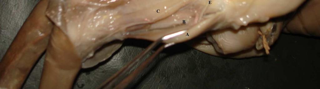 músculo extensor longo do dedo; B) músculo fibular terceiro; C) músculo