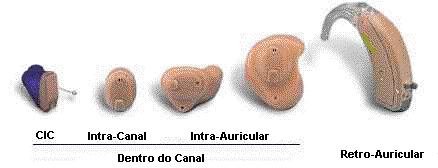 39 Depois de realizada a inscrição na Divisão de Saúde Auditiva, o tratamento é iniciado e o paciente é acompanhado durante todo processo de reabilitação.