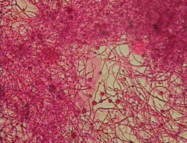 Com os cultivos em que houve a indução da formação de clamidósporos, foi realizado um teste onde o micélio foi