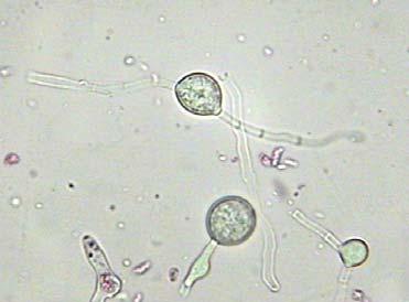 Figura 28 Microscopia óptica de fragmentos de hifas com clamidósporos, após o micélio cultivado para inóculo ser batido por 10 ciclos de 15 segundos. Hifa (seta vermelha) e clamidósporos (seta preta).