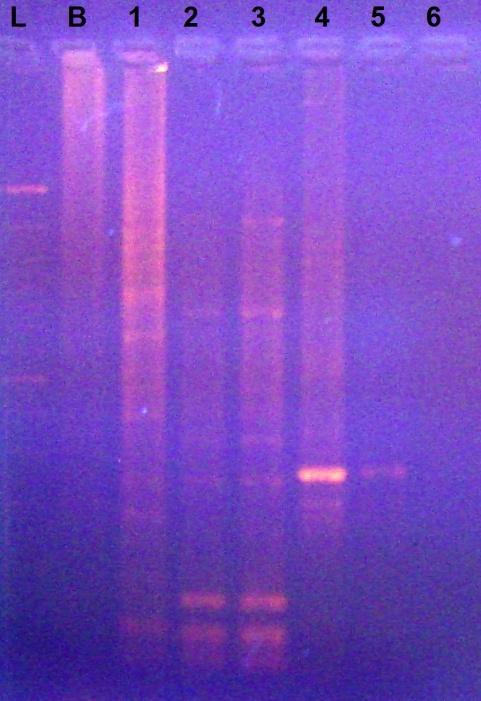 Figura 3. Amplificação das amostras de Aspergillus através da técnica RAPD.Coluna L corresponde ao Ladder 100pb Invitrogen. Coluna B corresponde ao controle branco da reação.