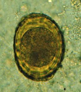 Possui cerca de 50 µm de diâmetro, são ovais e possui membrana mamilonada. (CIMERMAN; CIMERMAN, 2005; NEVES, 2005).