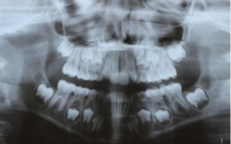 29 Figura 4 Radiografia Panorâmica da paciente K. L.