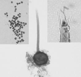 Ceratocystis fimbriata a) Peritécio maduro b) secção da base do peritécio, com ascos c) ascos com ascósporos d) ascósporos.