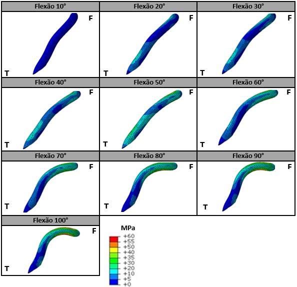 Tabela 47 - Gradientes de tensões de Von Mises presentes no enxerto ligamentar em posição FC- TA ao longo do movimento de flexão da articulação tibiofemoral.