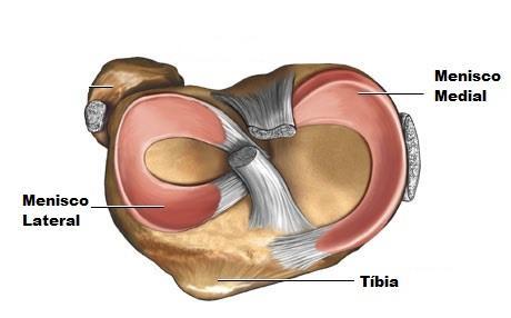 2.2.2 Patela A patela, juntamente com o fémur formam a articulação patelo-femoral. Esta articulação é importante para a estabilidade devido à sua função no mecanismo de extensão (4).