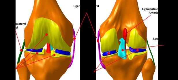 comportamento do ligamento, visto que no modelo nativo a parte inferior deste ligamento estava desacoplada, não contribuindo para a estabilidade articular na futura simulação.