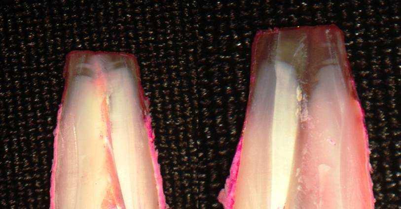 20 Após secos, os dentes foram clivados utilizando-se um disco diamantado de dupla face KG Sorensen (São Paulo), montado em uma peça de mão reta.