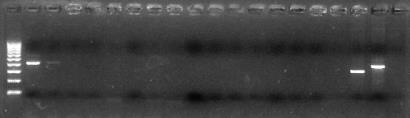 8 - Electroforese em gel de agarose 2% dos produtos do PCR-Simples.