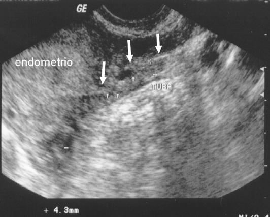 identificação pela ultra-sonografia.