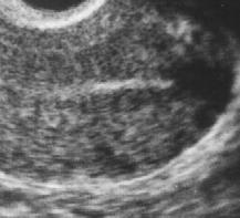Após a ovulação, com a formação do corpo lúteo, inicia-se a secreção