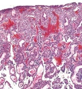 As glândulas endometriais tornam-se secretoras, tortuosas, com