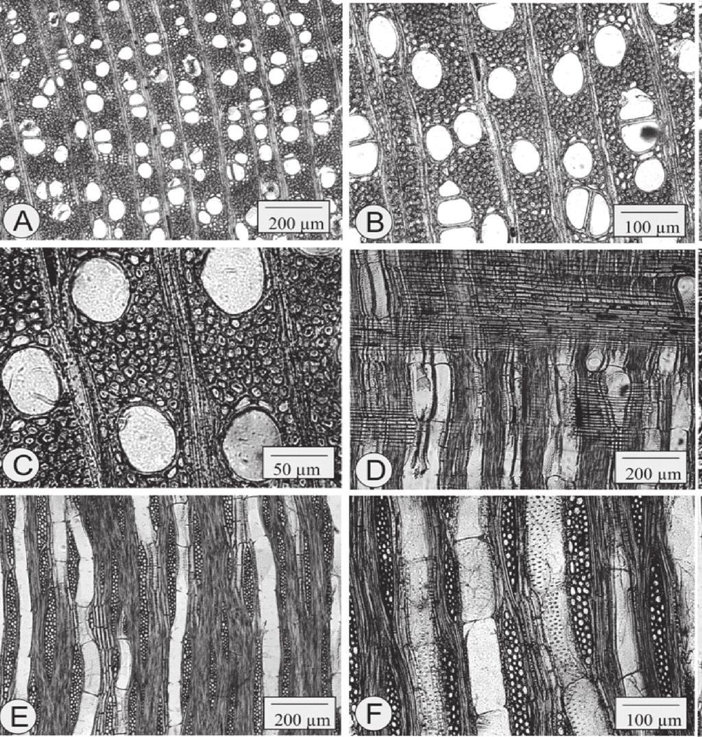 FIGURA 2: Fotomicrografias do lenho da amostra BFA 8217. A Parênquima paratraqueal abundante (seção transversal). B, C Mesma seção, em maior aumento.