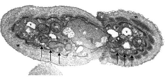 O núcleo possui uma membrana limitante bem definida ao redor de um nucleoplasma granular homogêneo.