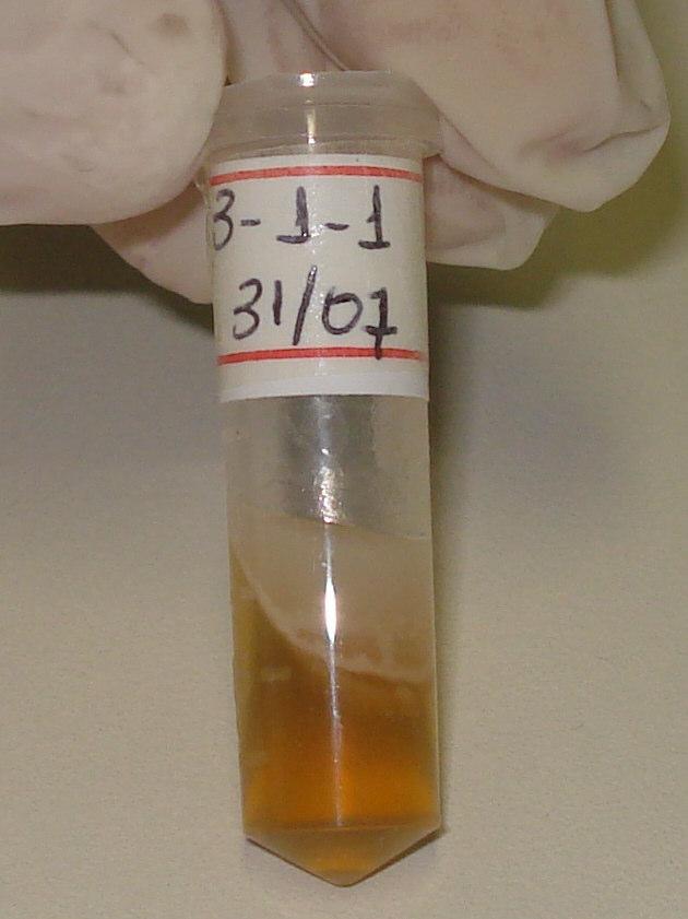 Figura 10: Tubos Ependorffs contendo ágar Dixon, inoculado com Malassezia spp.