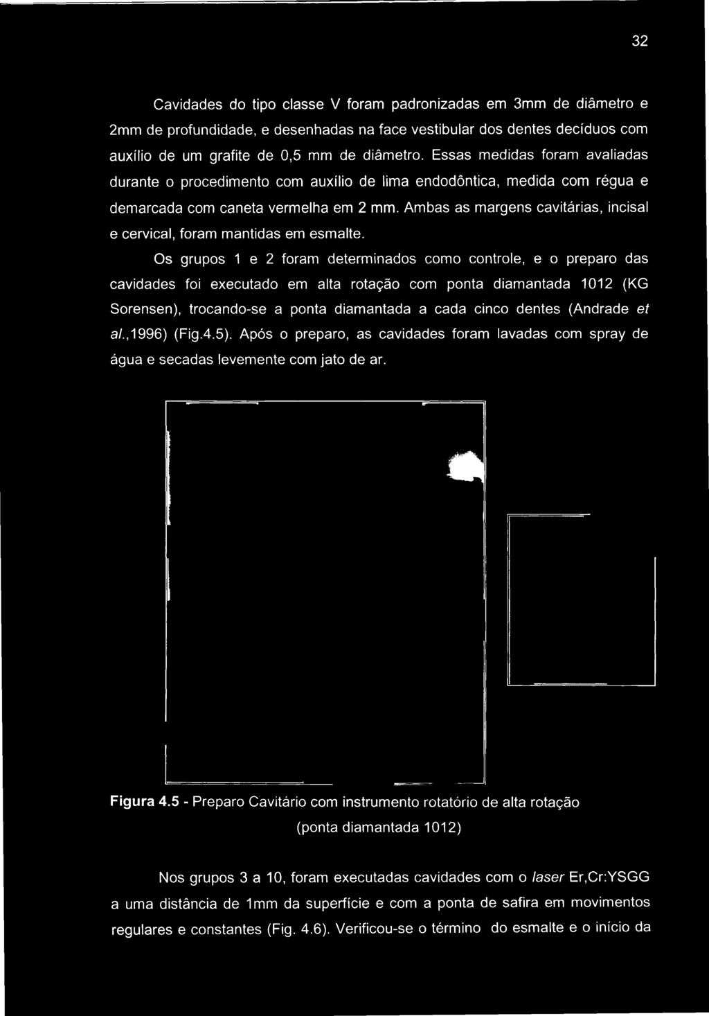 Essas medidas foram avaliadas durante o procedimento com auxílio de lima endodôntica, medida com régua e demarcada com caneta