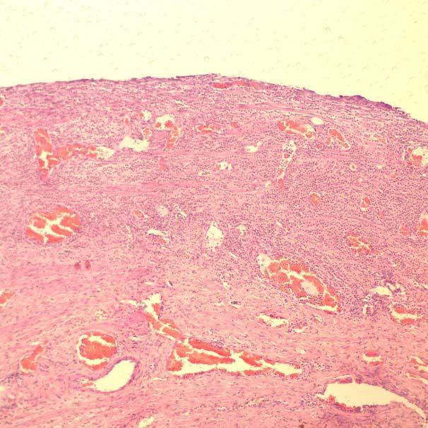 Observar testículo neoplásico abdominal (seta vermelha); Porção cranial da vagina que estava conectada a próstata (seta verde) e testículo hipoplásico escrotal (seta amarela).