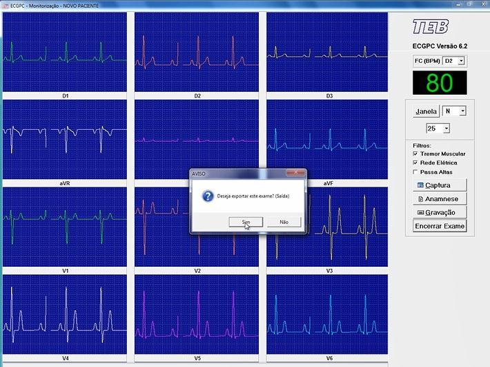 21. Uma caixa se abrirá com a pergunta: Deseja exportar este exame? Responda Sim. 22.