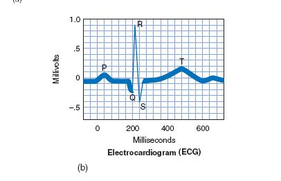 Capítulo 2 REVISÃO DE LITERATURA 20 Figura 1 Exemplo de traçado eletrocardiográfico Fonte: Graaf, (2001). Na figura 1 observa-se uma inscrição eletrocardiográfica.