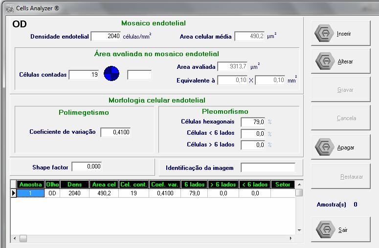 Métodos 53 3.5.2 Inserção dos resultados da análise das imagens endoteliais, gerados pelo microscópio especular de córnea, no programa Cells Analyzer PAT. REQ.