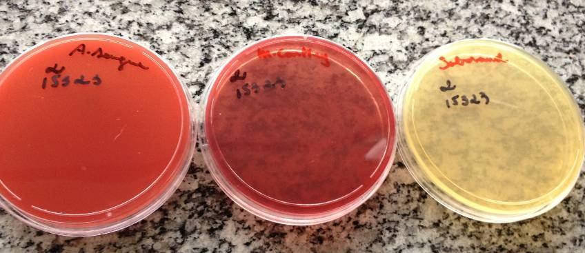 Coleta (Agar Sangue, Agar McKonkey e Agar Sabouraud), diferente do que ocorreu nas outras