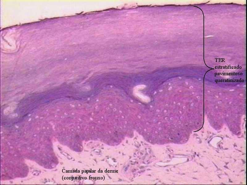 EPITÉLIO SIMPLES CILÍNDRICO: Reveste estômago e intestinos órgãos de secreção e absorção.