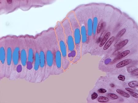 Epitélio simples prismático (ou colunar) que reveste internamente o intestino delgado. É bem visível o formato das células e dos seus núcleos alongados.