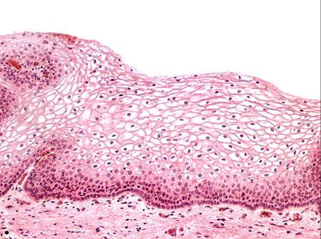 Nesta imagem de epitélio pavimentoso estratificado da vagina o citoplasma da maioria das células está pouco corado permitindo observar os