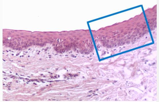 Região apical Superfície externa Cavidade corporal