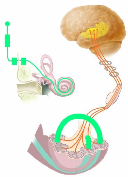 Revisão de literatura 10 Figura 1. Localização do feixe de eletrodos na cóclea e a transmissão dos estímulos pelas vias auditivas centrais até o córtex auditivo. Rauschecker, J.P.; Shannon, R.V.