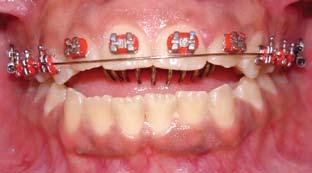 Orthodontic Sci. Pract. 2011; 4(16): 859-866 861 to.