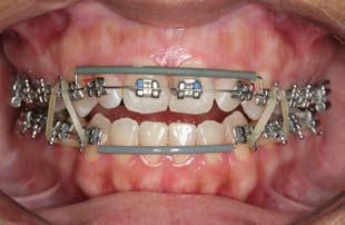 Orthodontic Sci. Pract.