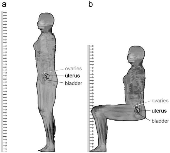 Entretanto, estes simuladores não possuem órgãos internos, então foi considerado uma mistura homogênea de 50 % de musculo e 50 % de tecido mole com densidade de 1,05 g/cm 3. Figura 3.6.