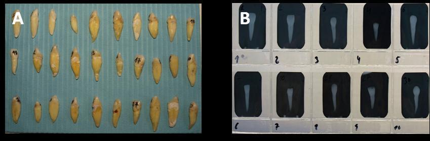 Fig. 3 (A) Fotografia da amostra (30 dentes monorradiculares) utilizada no estudo. (B) Fotografia dos Rx iniciais da amostra nº1à nº10. 2.